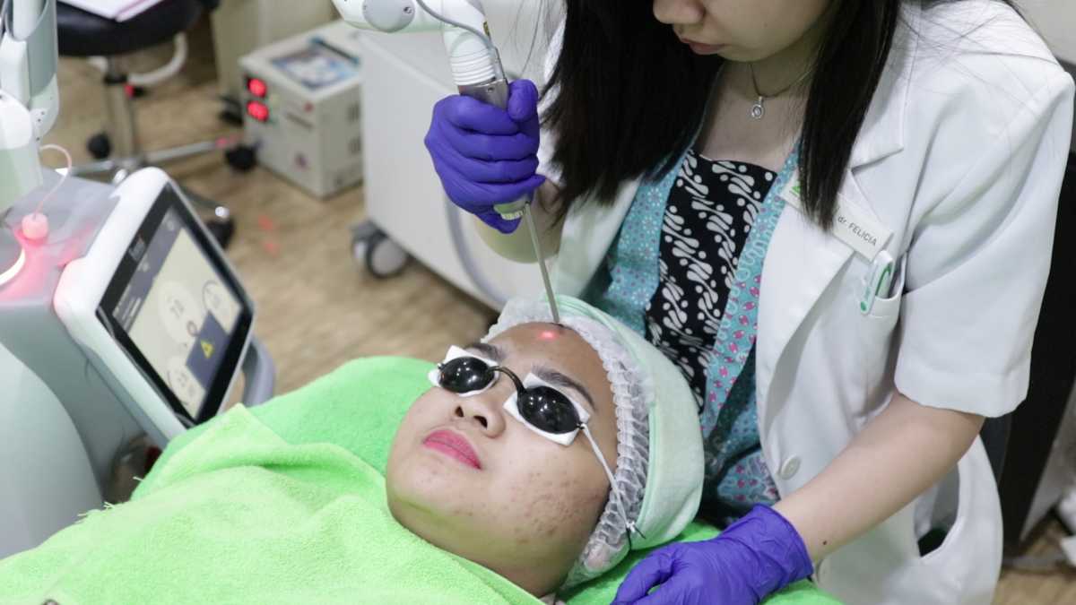 Laser Jerawat Masih Banyak Disukai Millineal Laser Jerawat Masih Banyak Disukai Millineal