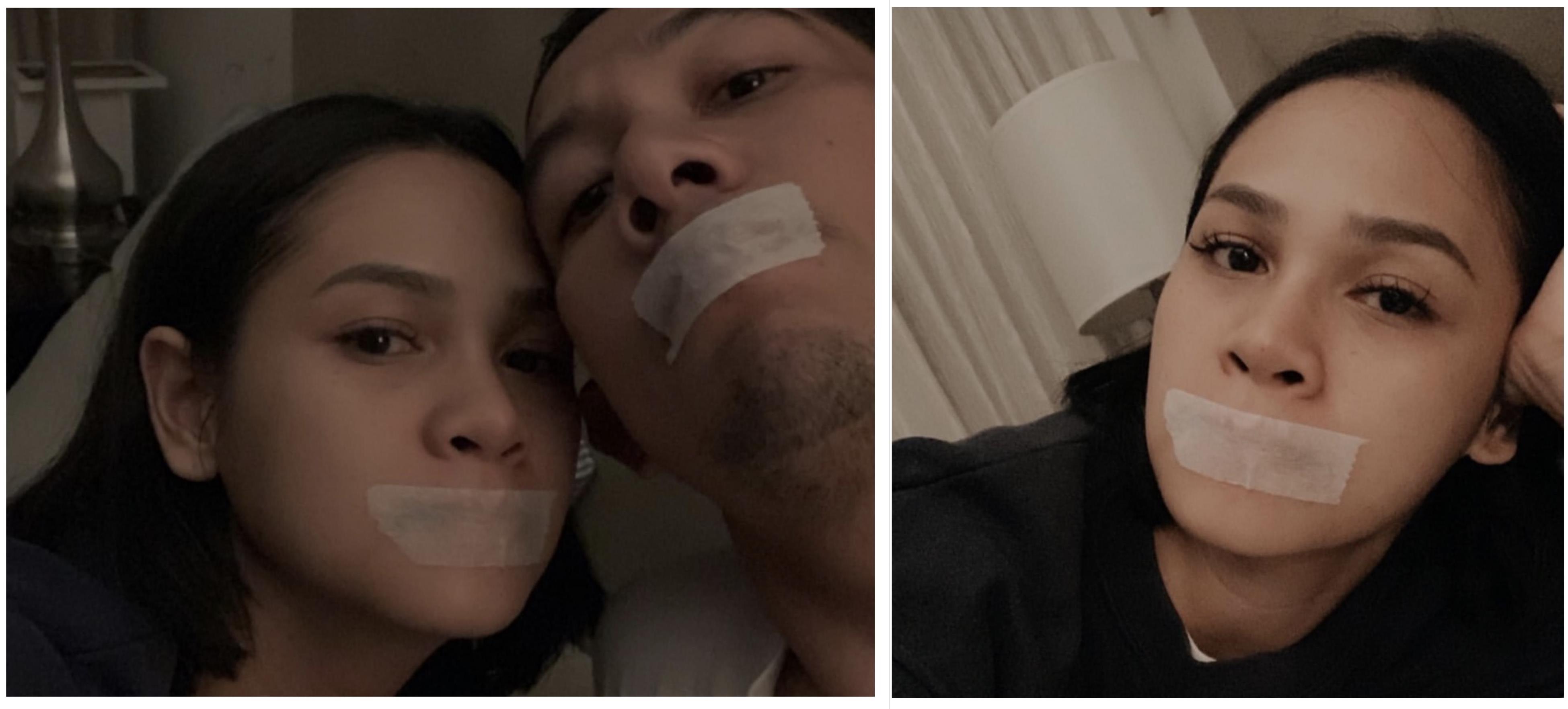 Mulut Diplester Saat Tidur, Apa Kata Dokter? Mulut Diplester Saat Tidur, Apa Kata Dokter?