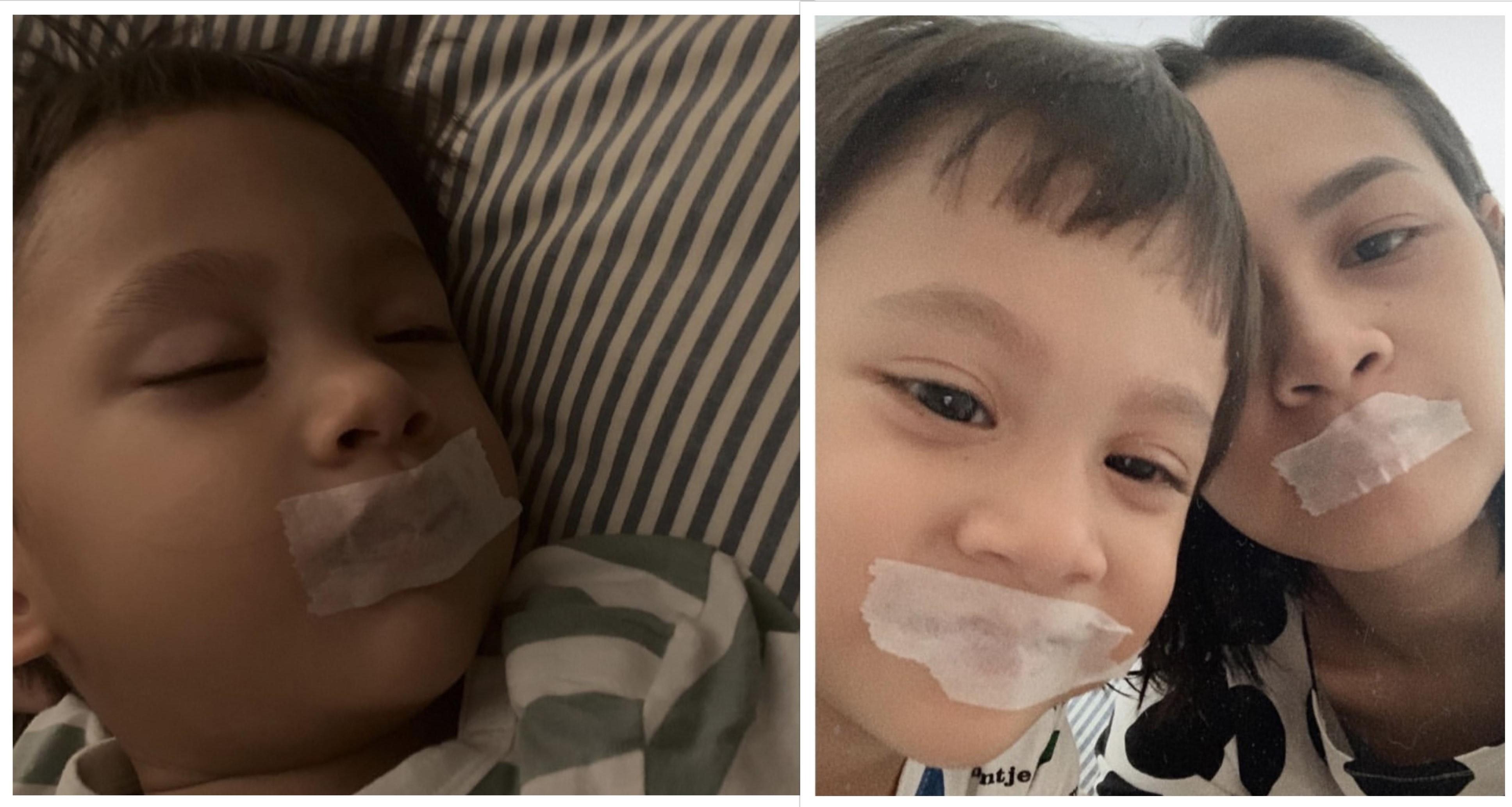 Amankah Plester Mulut Anak Saat Tidur? Amankah Plester Mulut Anak Saat Tidur?