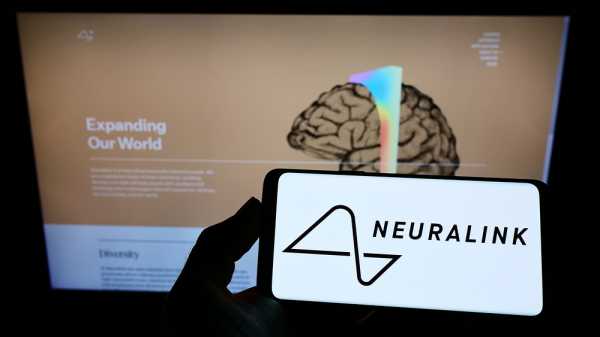 Proyek Gila Tanam Chip ke Otak Manusia 'Neuralink' Sudah Kantongi Izin Proyek Gila Tanam Chip ke Otak Manusia 'Neuralink' Sudah Kantongi Izin