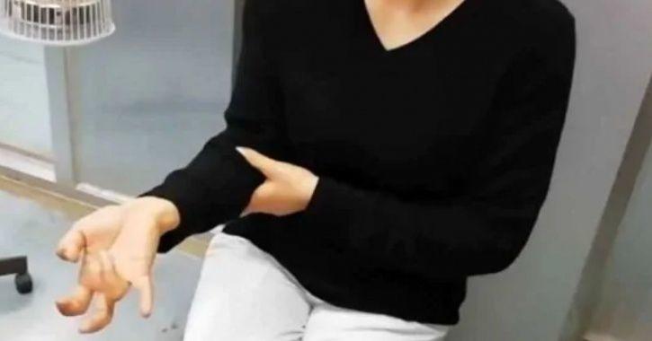 Duh! Kelamaan Main Ponsel, Tangan Wanita Ini “Mati Jari” Duh! Kelamaan Main Ponsel, Tangan Wanita Ini “Mati Jari”