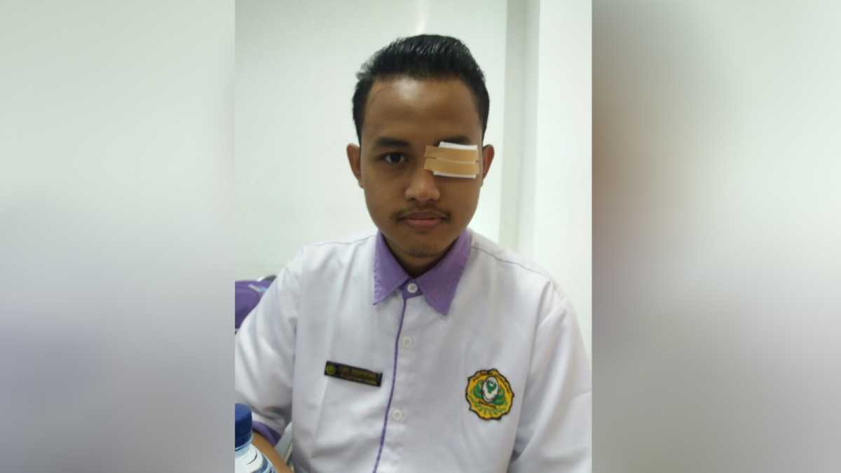 Mata Pria Ini Infeksi Karena Bara Rokok Pengendara Motor Mata Pria Ini Infeksi Karena Bara Rokok Pengendara Motor