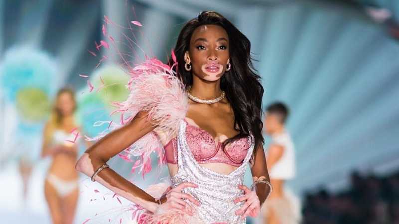 Winnie Harlow, Model Vitiligo Pertama di Show Victorias 