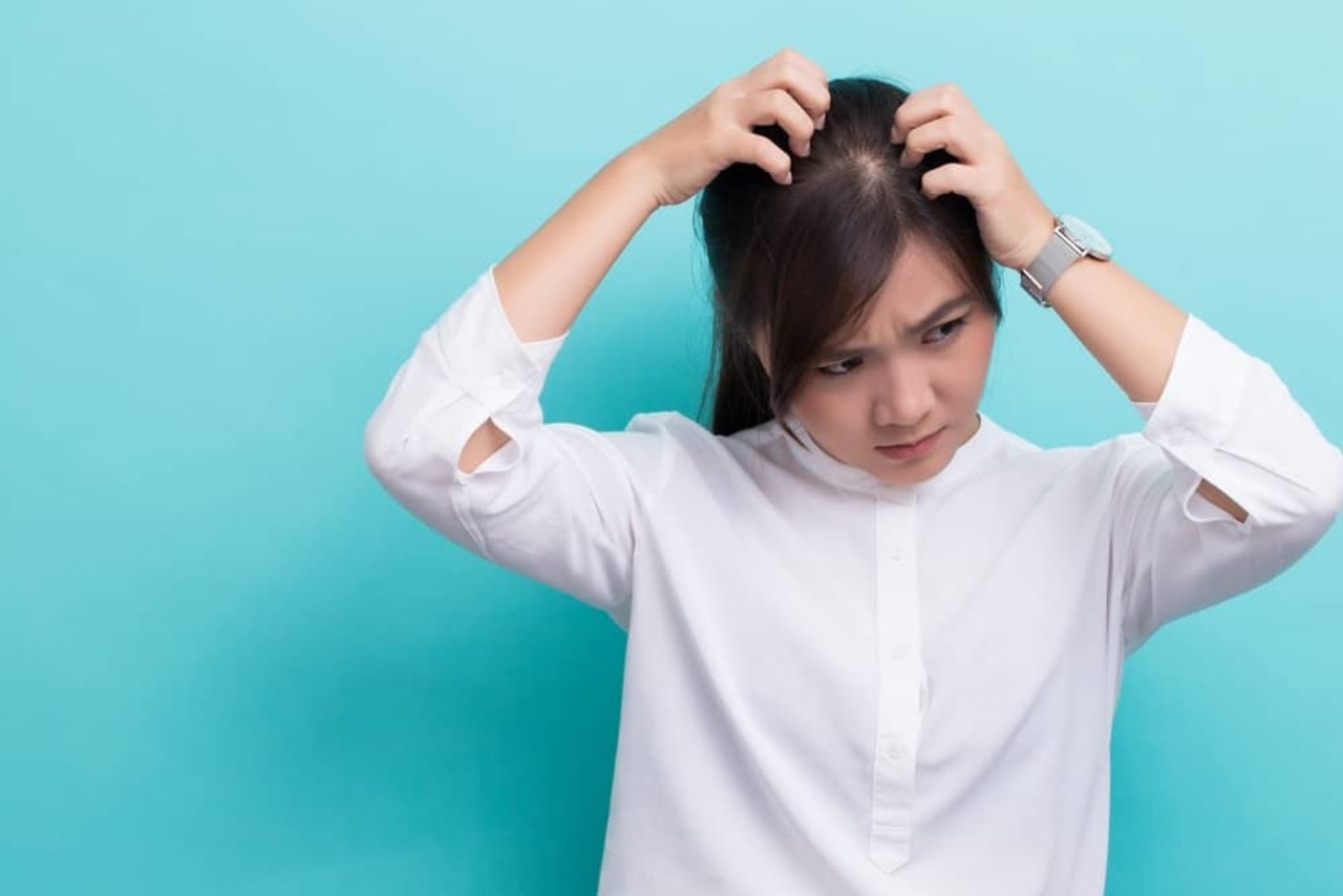 6 Cara Ampuh Hilangkan Ketombe 6 Cara Ampuh Hilangkan Ketombe