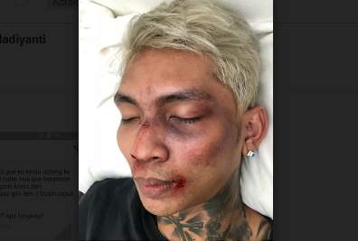 Berbohong Soal Dipukuli Penggemar K-Pop, Young Lex: Ngapain Minta Maaf Berbohong Soal Dipukuli Penggemar K-Pop, Young Lex: Ngapain Minta Maaf